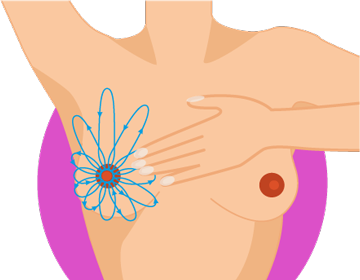 Die Tastuntersuchung mit kreisenden nach oben führenden Bewegungen